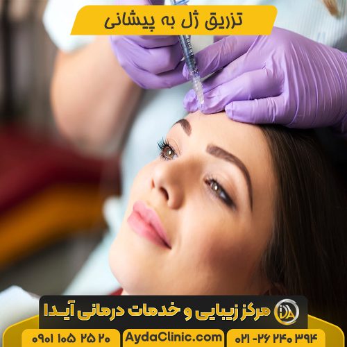 تزریق ژل به پیشانی